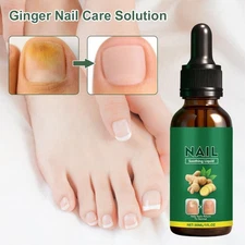 Ginger Nail Care Solution, Nail Soothing Liquid Help NEW Return Nails to Y2D1