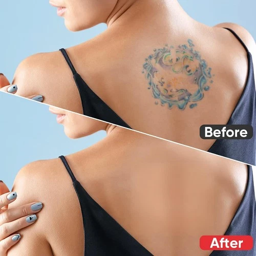 Tattoo Cover Up Patch, Waterproof & Breathable, for Tattoos & Scars, 6Pcs image 2