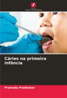 Pramada Prabhakar | CáRies Na Primeira InfâNcia | Taschenbuch | Portugiesisch