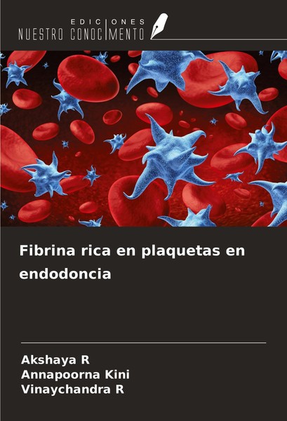 Fibrina Rica En Plaquetas En Endodoncia Akshaya R-image