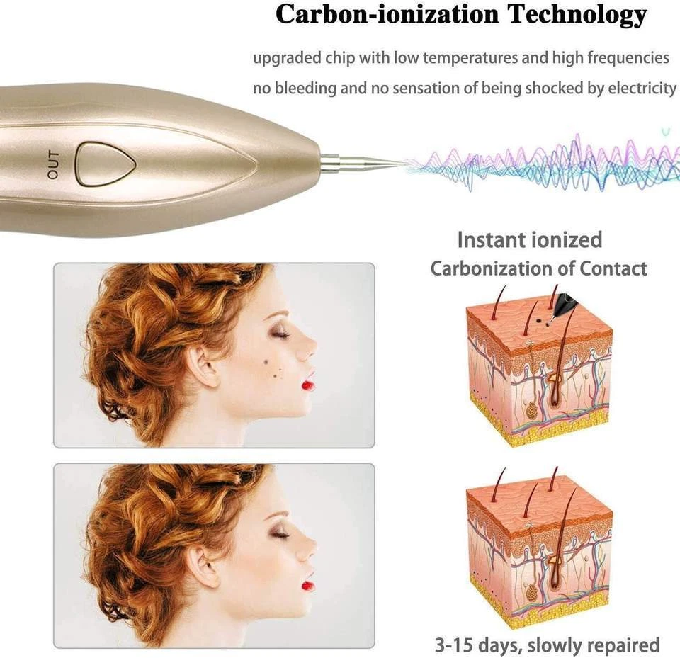 9 Level LCD Laser Plasma Pen Dark Spot Removal Freckle Skin Tag Tattoo Removal - Image 4 of 4