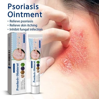 20g Psoriasis Ointment Cream for Relieve Itching Moisturize Dry Irritated Skin