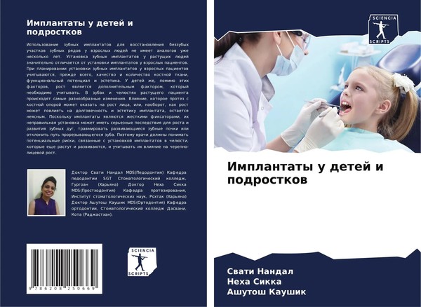Implantaty U Detej I Podrostkow Swati Nandal (U. A.) Taschenbuch Russisch 2024-image