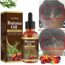 30ml Natural Batana Rosemary Oil Serum for Hair Growth Anti Hair Loss Hair Oil