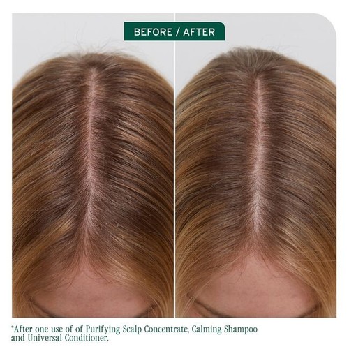 Acondicionador universal Biolage Scalp Sync 8 oz - Imagen 2 de 6