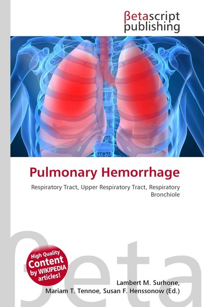 Lambert M. Surhone (U. A.) | Pulmonary Hemorrhage | Taschenbuch | Englisch-image