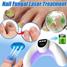 Nail Fungus Laser Nail Fungus Cleaning LED Light Device for Multiple Toenail US