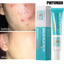 Salicylic Acid Acne Cream Anti-Pimple Spot Treatment Oil Control Skin Care