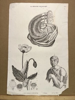 Antiquarische Kupferstisch 1834 Anatomie Medizine Chirurgie Arzt Doktor Botanik - Bild 1 von 4