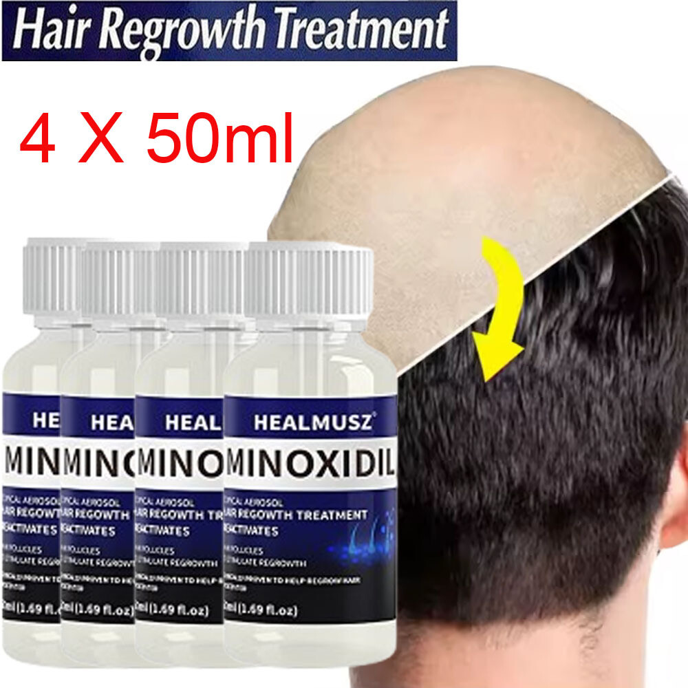 4Pcs Minoxidil 5% Hair Regrowth Treatment Hair Loss &Growth Scalp Liquid For Men