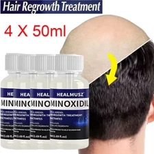4Pcs Minoxidil 5% Hair Regrowth Treatment Hair Loss &Growth Scalp Liquid For Men