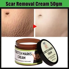 Best Scar Removal-Cream for Old-Scars Stretch Mark Removal Cream 50g