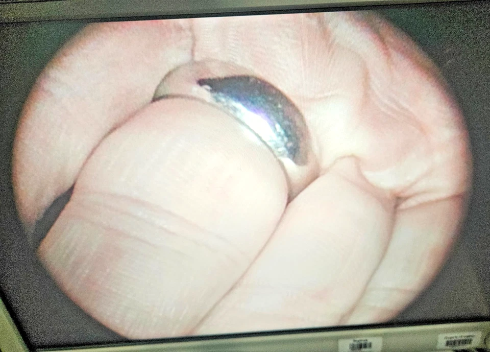 Laparoscopio Stryker 10 mm 0 grados, 502-457-010, autoclavable. Foto 2 de 4