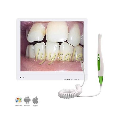 17'' Digital LCD AIO Monitor Dental Intraoral Camera High Definition Imaging