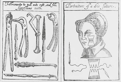 Instruments for pulling teeth a jaw suture from Peter Lowe's A Dis- Old Photo