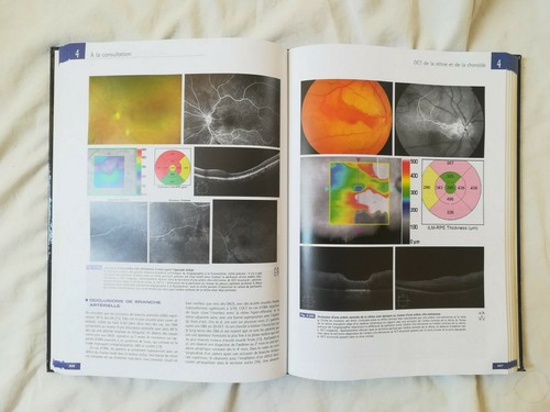 OCT en ophtalmologie Rapport de la Société Française d'ophtalmologie French Book - 第 5/7 張圖片