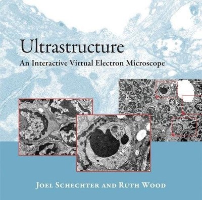 ULTRASTRUCTURE: AN INTERACTIVE VIRTUAL ELECTRON MICROSCOPE By Joel E. Schechter