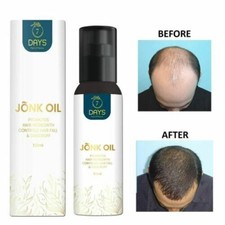 New Arrival Smoothing Repairing Anti Loss Regrowth Scalp Elixirs Hair Growth Oil