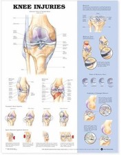 Knee Injuries Anatomical Chart, Paperback by Anatomical Chart Company EDT , ...