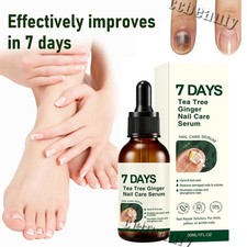Tea Tree Ginger Nail Treatment Oil Thickened Nails Nail Repair Serum Nail Care