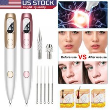 Electric Laser Plasma Pen Freckle Dot Mole Tattoo Removal Beauty Machine 9 Level