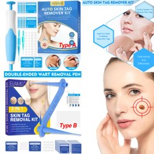 2in1 Painless Auto Skin Tag Mole Wart Removal 40x Rubber Bands 10x Alcohol Pad 