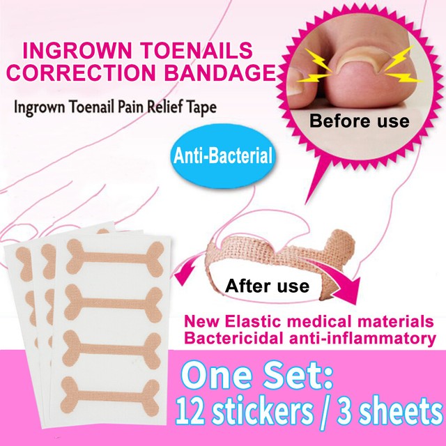 12pcs ingrown toenails band Aid relief pain Paronychia correction