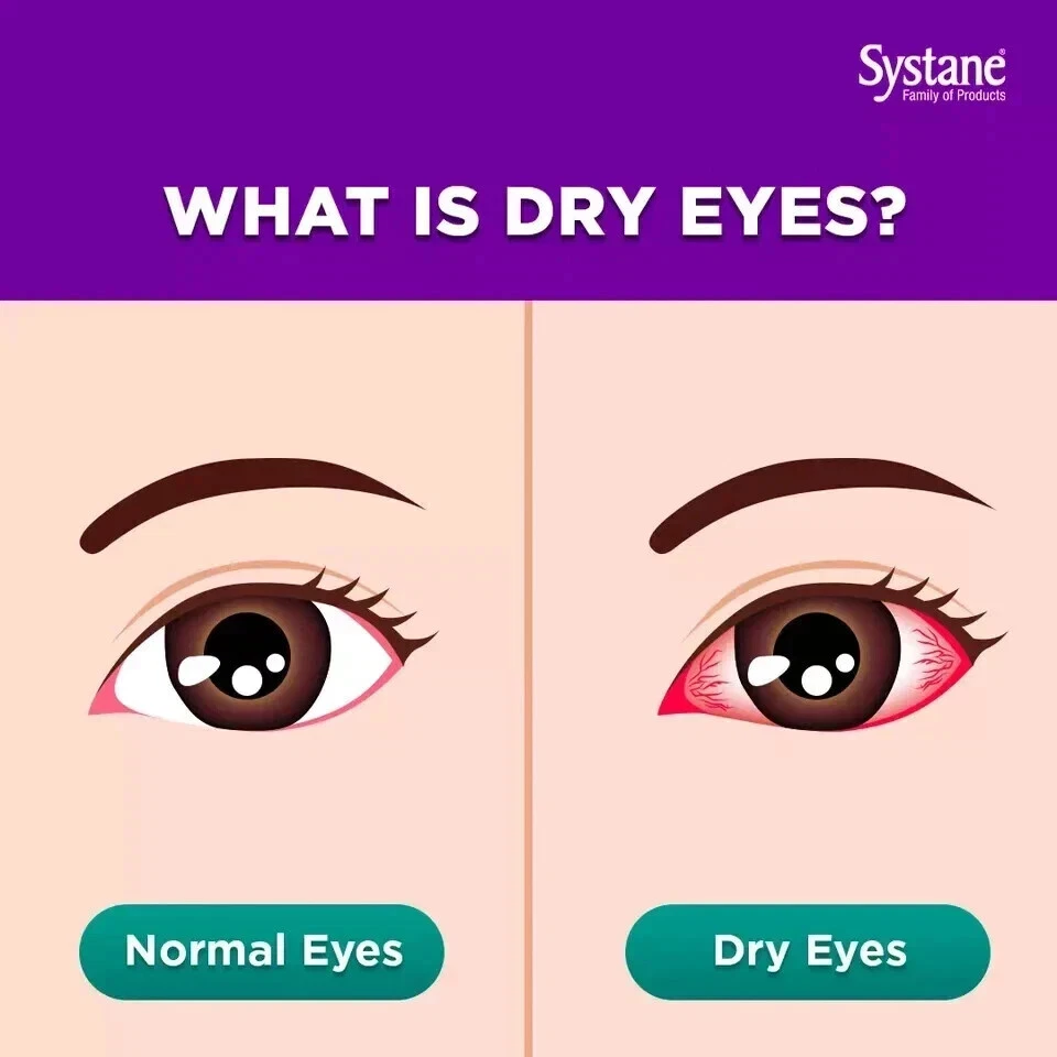 NEW ALCON SYSTANE Ultra Lubricant Eye Drops High Performance 5ML ( X 6 ) - Image 3 of 4