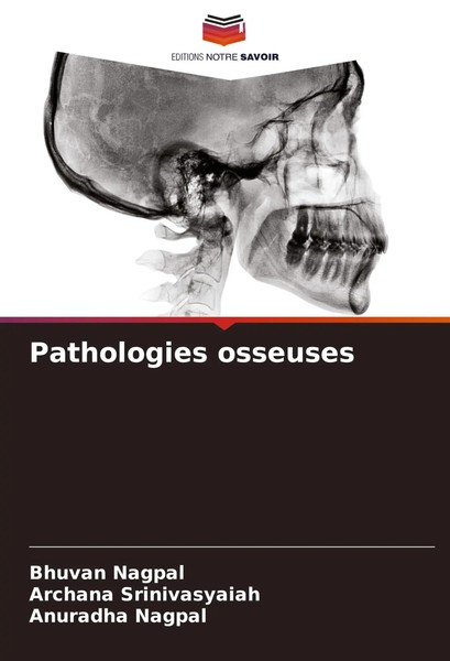 Bhuvan Nagpal (U. A.) | Pathologies Osseuses | Taschenbuch | FranzöSisch (2025)-image