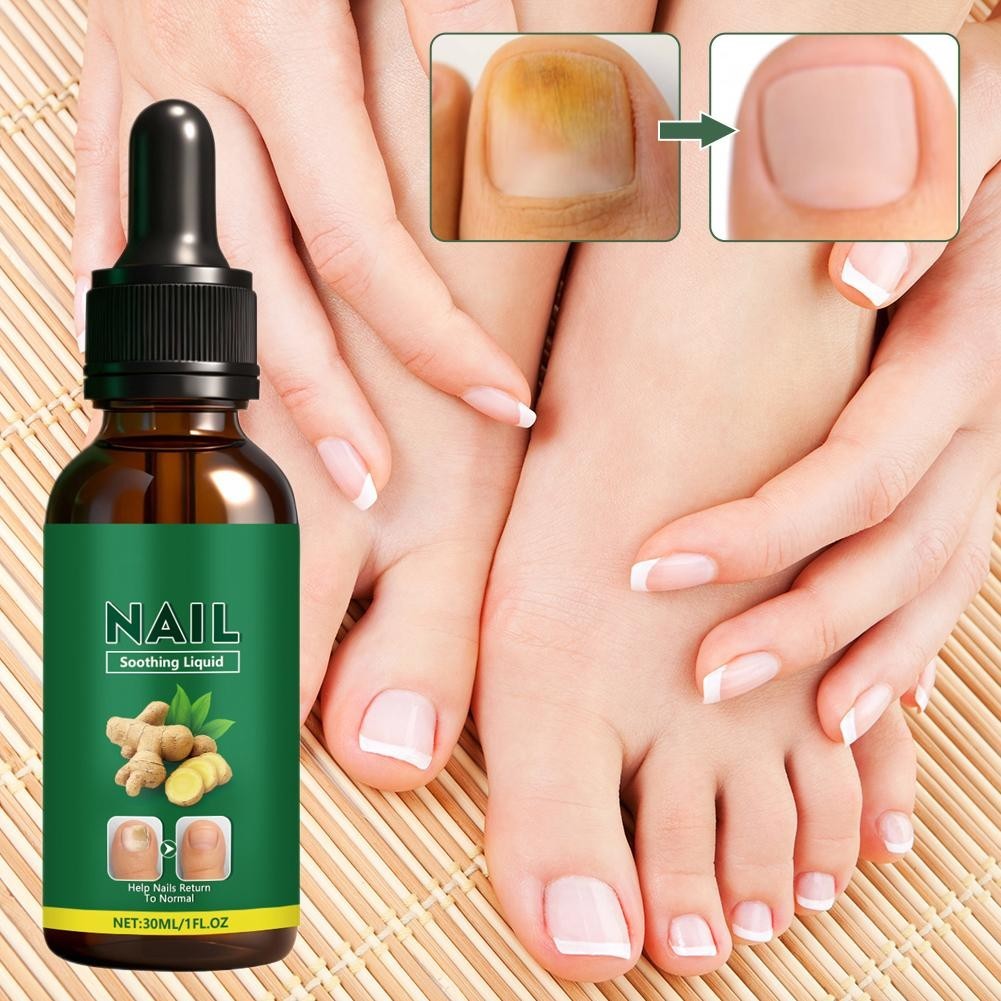Ginger Nail Care Solution, Nail Soothing Liquid Help NEW Return Nails to Y2D1