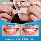 Teeth Whitening Strips 7-Day Treatment 14 14 Count (Pack of 1), White