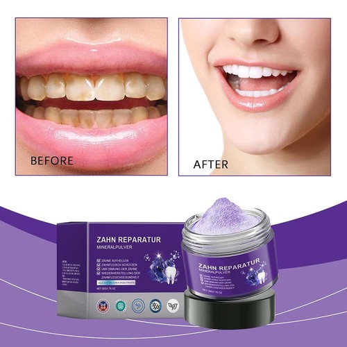 Dental Restoration Mineral Powder, Mineral Tooth Powder, Teeth Whitening 50gUK/ - Picture 4 of 12