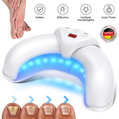 Nagelpilz Laser Geräte schnelle Reparatur Fußpilz Laserbehandlung für zuhause DE