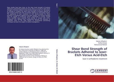 Shear Bond Strength of Brackets Adhered to laser-Etch Versus Acid-Etch Hakam Alf