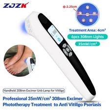 308nm Handheld UV Lamps Home Use UVB Light Phototherapy with Goggles 35mW/cm²
