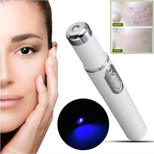 Blue Light Therapy Varicose Veins Pen - Soft Scar Wrinkle Removal New - UK - Picture 8 of 12