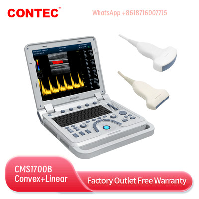 CMS1700B Color Doppler CF Ultrasound Scanner Machine Convex+Linear 2 Probes USG