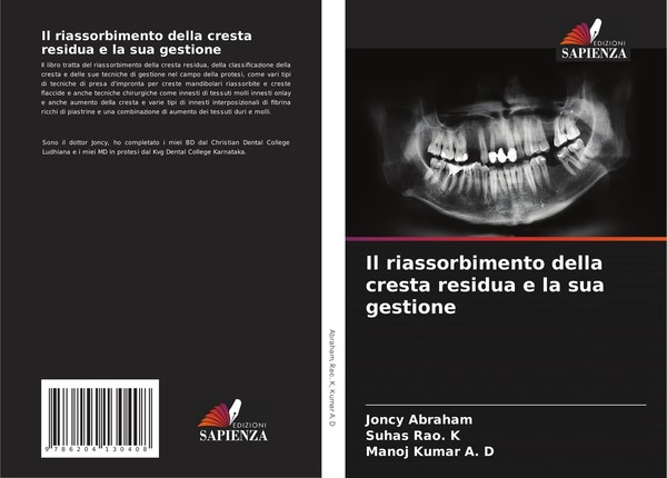 Il Riassorbimento Della Cresta Residua E La Sua Gestione Joncy Abraham-image