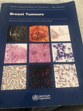 Breast Tumours: WHO - Paperback, by WHO Class...