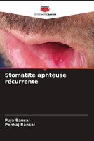 Puja Bansal (U. A.) | Stomatite Aphteuse RéCurrente | Taschenbuch | FranzöSisch