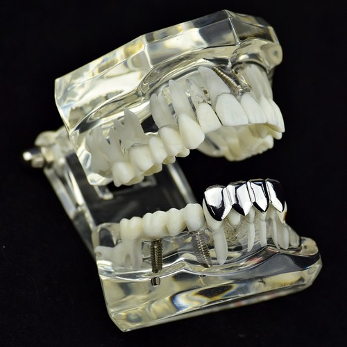 Grillz Cuatro 4 dientes dientes inferiores tono plateado fila inferior lisa hip hop parrilla - Imagen 2 de 6