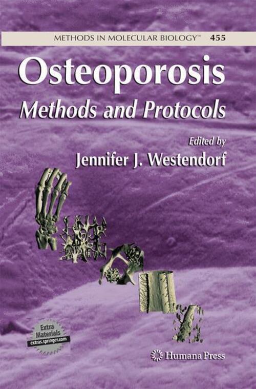 Thumbnail - Osteoporosis Methods And Protocols Jennifer Westendorf Taschenbuch