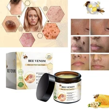 Bee Venom Skin Tag Removal Treatment Cream Body Care Mole Corn Wart Remover