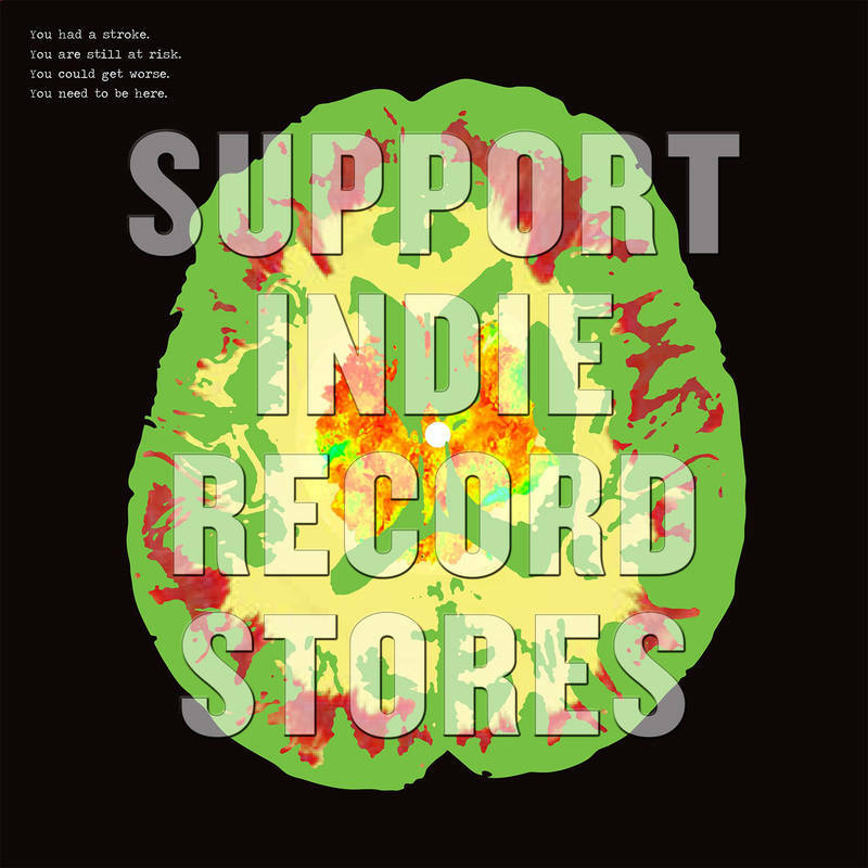 RSD19 Il Minus 5 Stroke Manor