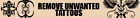 tattooremovalcreamshop