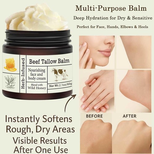 Beef Tallow for Skin - Organic Grass-Fed Whipped Beef Tallow and Honey Balm -... - Picture 6 of 7