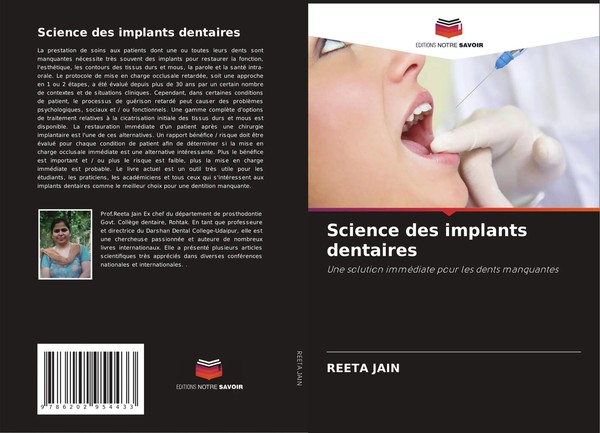 Reeta Jain | Science Des Implants Dentaires | Taschenbuch | FranzöSisch (2021)-image
