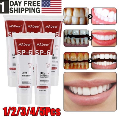5/3X Sp-6 Probiotics Whitening Toothpaste,Brightening&Breath Removing Toothpaste