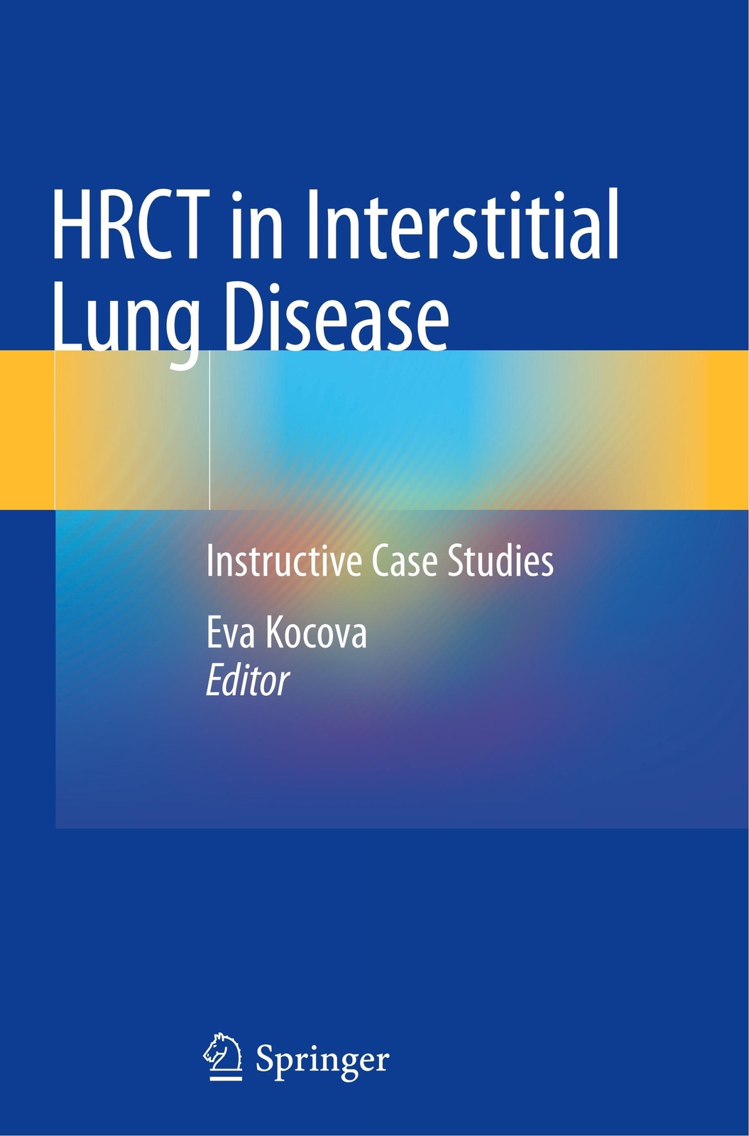 Thumbnail - Hrct In Interstitial Lung Disease | Instructive Case Studies | Eva