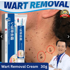 Wart Removal Cream 30g Fast Acting Skin Care Treatment for Hands Feet Body